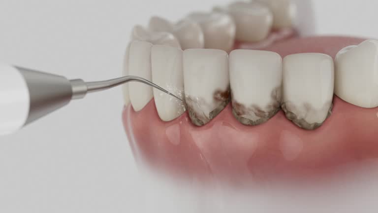 Reliable Dental contractor in Gold Key Lake, PA by Dentist Open Now